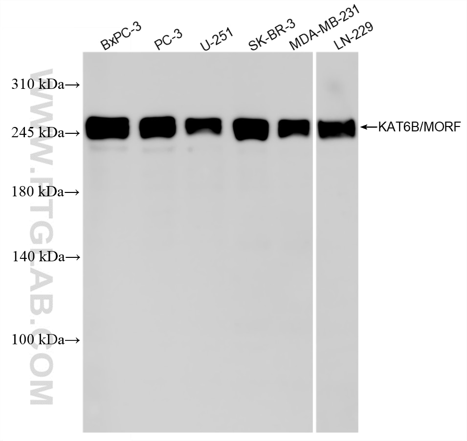 Western Blot (WB) analysis of various lysates using KAT6B/MORF Recombinant monoclonal antibody (86962-12-RR)