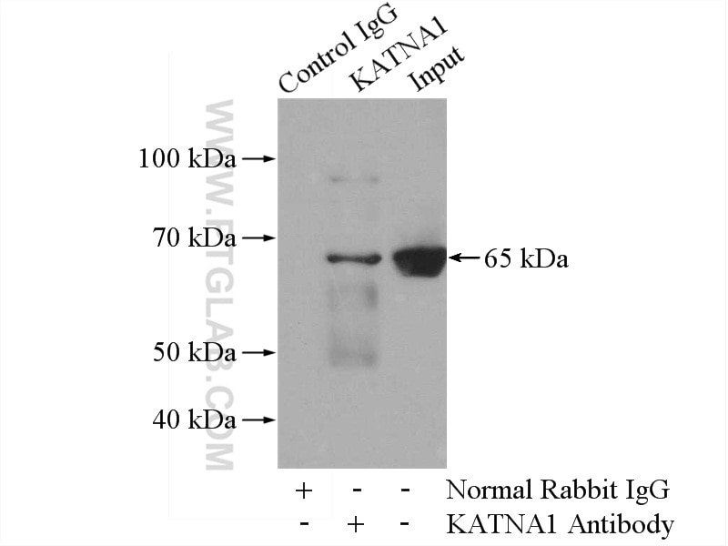 Immunoprecipitation (IP) experiment of mouse brain tissue using KATNA1 Polyclonal antibody (17560-1-AP)