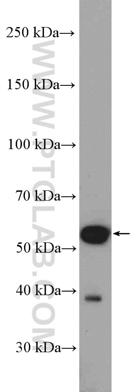 Western Blot (WB) analysis of rat brain tissue using KATNA1 Polyclonal antibody (17560-1-AP)