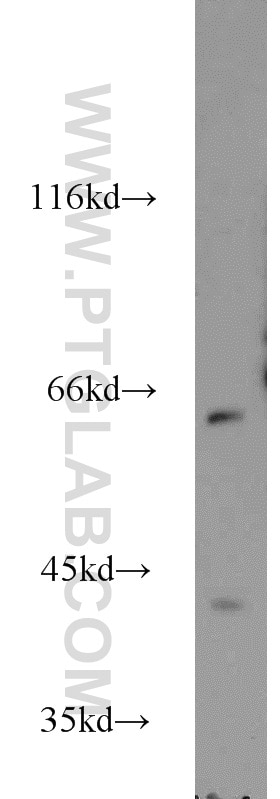 Western Blot (WB) analysis of mouse brain tissue using KATNA1 Polyclonal antibody (17560-1-AP)