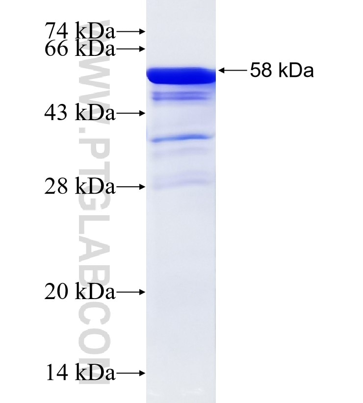 KATNA1 fusion protein Ag11753 SDS-PAGE