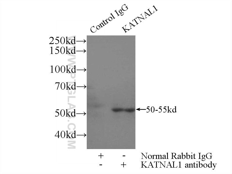 Immunoprecipitation (IP) experiment of HeLa cells using KATNAL1 Polyclonal antibody (20166-1-AP)