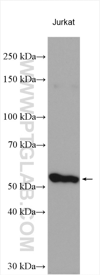 Western Blot (WB) analysis of various lysates using KATNAL1 Polyclonal antibody (20166-1-AP)