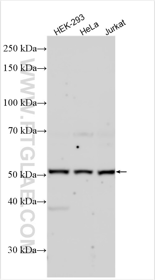 Western Blot (WB) analysis of HEK-293 cells using KATNAL1 Polyclonal antibody (20166-1-AP)