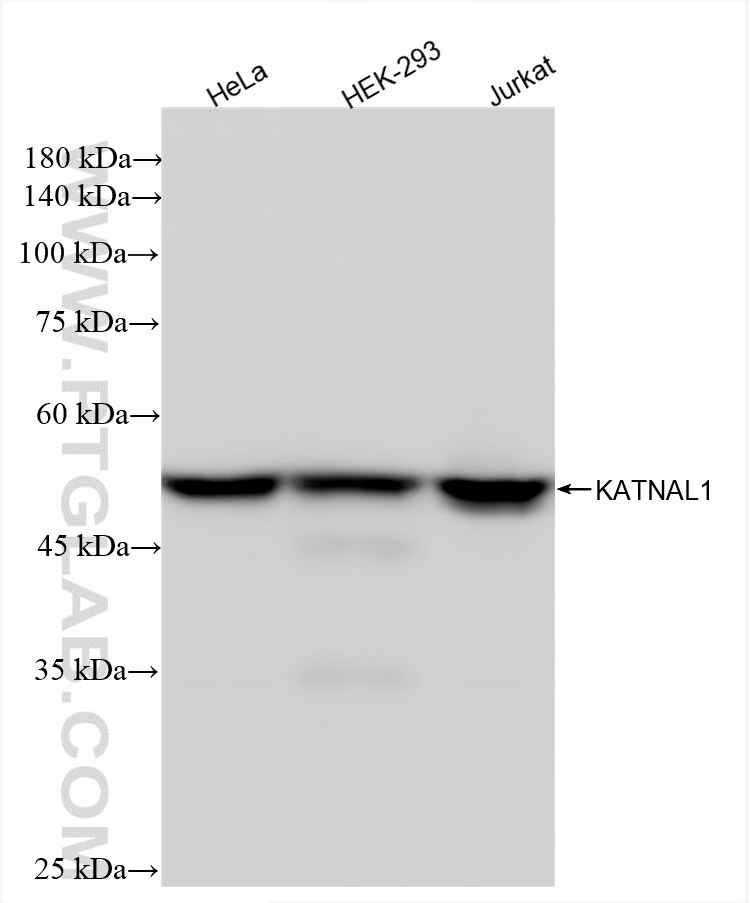 Western Blot (WB) analysis of various lysates using KATNAL1 Recombinant antibody (85382-1-RR)