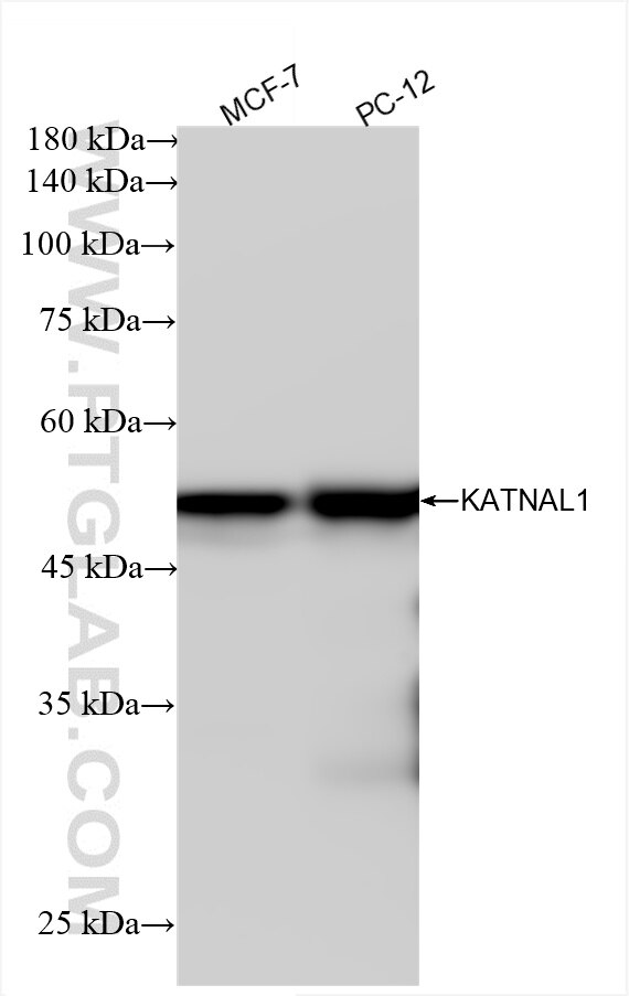 Western Blot (WB) analysis of various lysates using KATNAL1 Recombinant antibody (85382-1-RR)