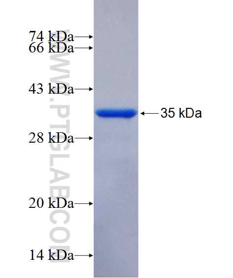 KATNAL1 fusion protein Ag13960 SDS-PAGE