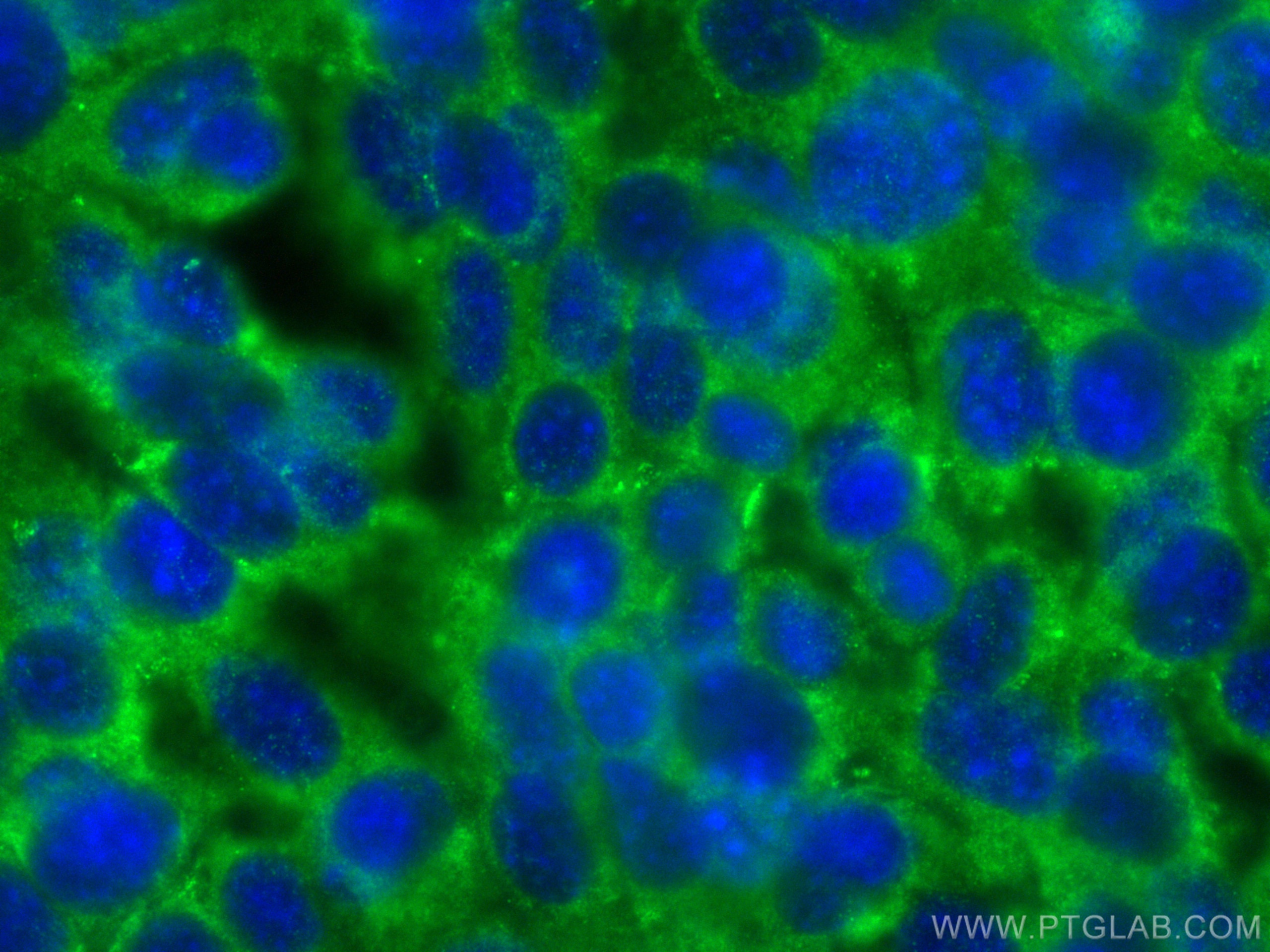 Immunofluorescence (IF) / fluorescent staining of NIH/3T3 cells using KATNAL2 Polyclonal antibody (17074-1-AP)