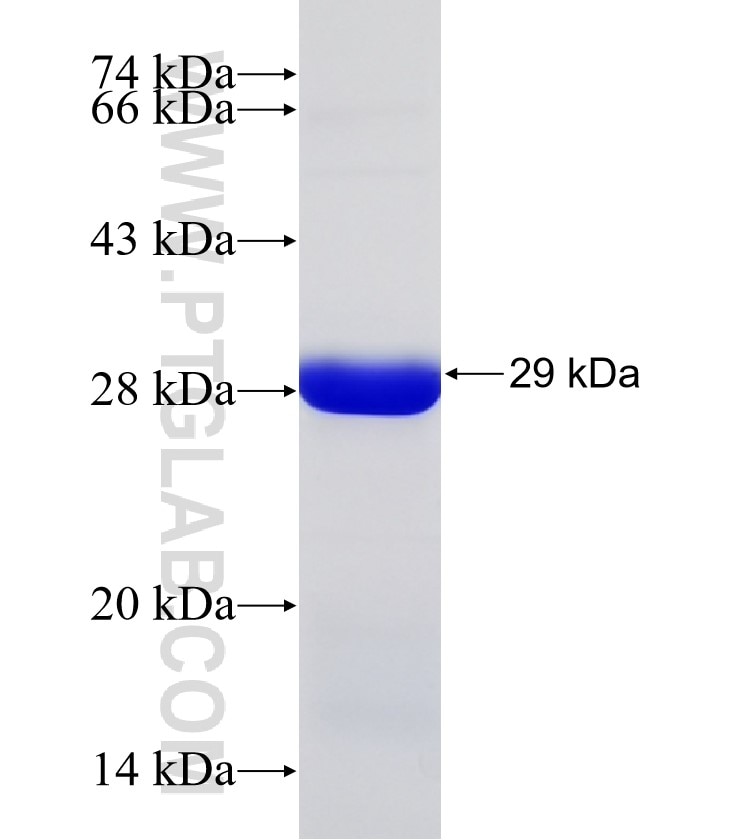 KATNAL2 fusion protein Ag31156 SDS-PAGE KATNAL2 fusion protein Ag31156 SDS-PAGE