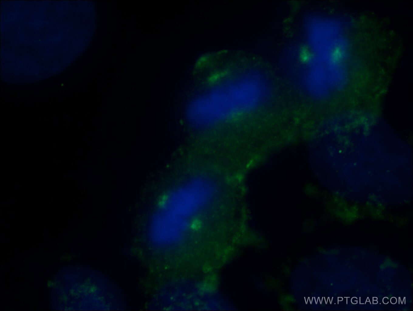 Immunofluorescence (IF) / fluorescent staining of HeLa cells using KATNB1 Polyclonal antibody (14969-1-AP)