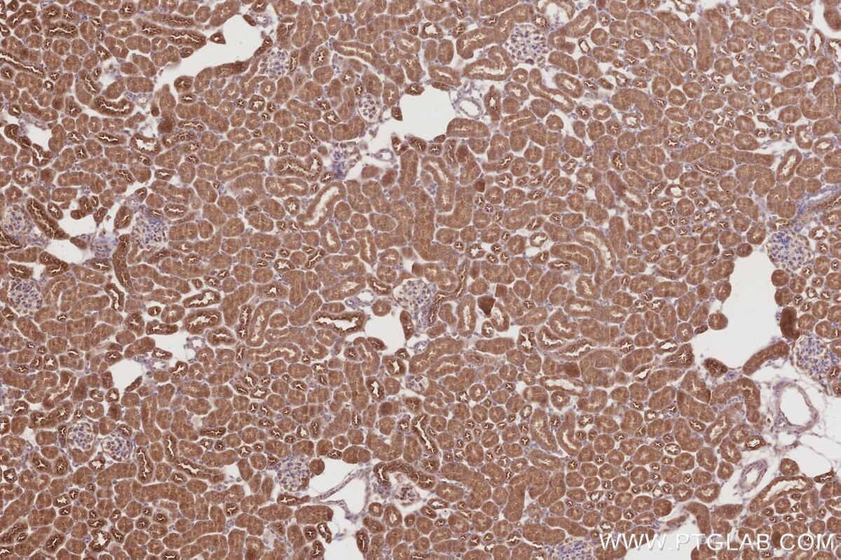 Immunohistochemistry (IHC) staining of mouse kidney tissue using KATNB1 Polyclonal antibody (14969-1-AP)