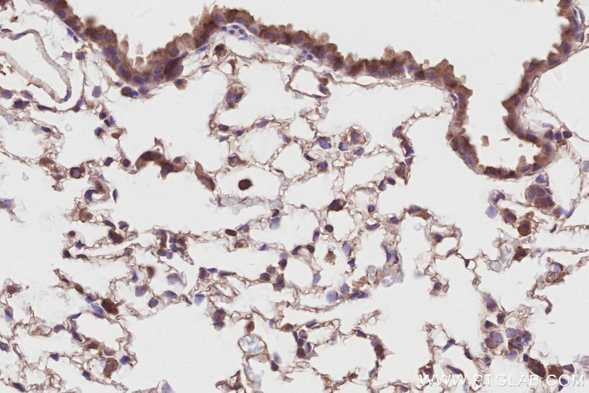 Immunohistochemistry (IHC) staining of mouse lung tissue using KATNB1 Polyclonal antibody (14969-1-AP)