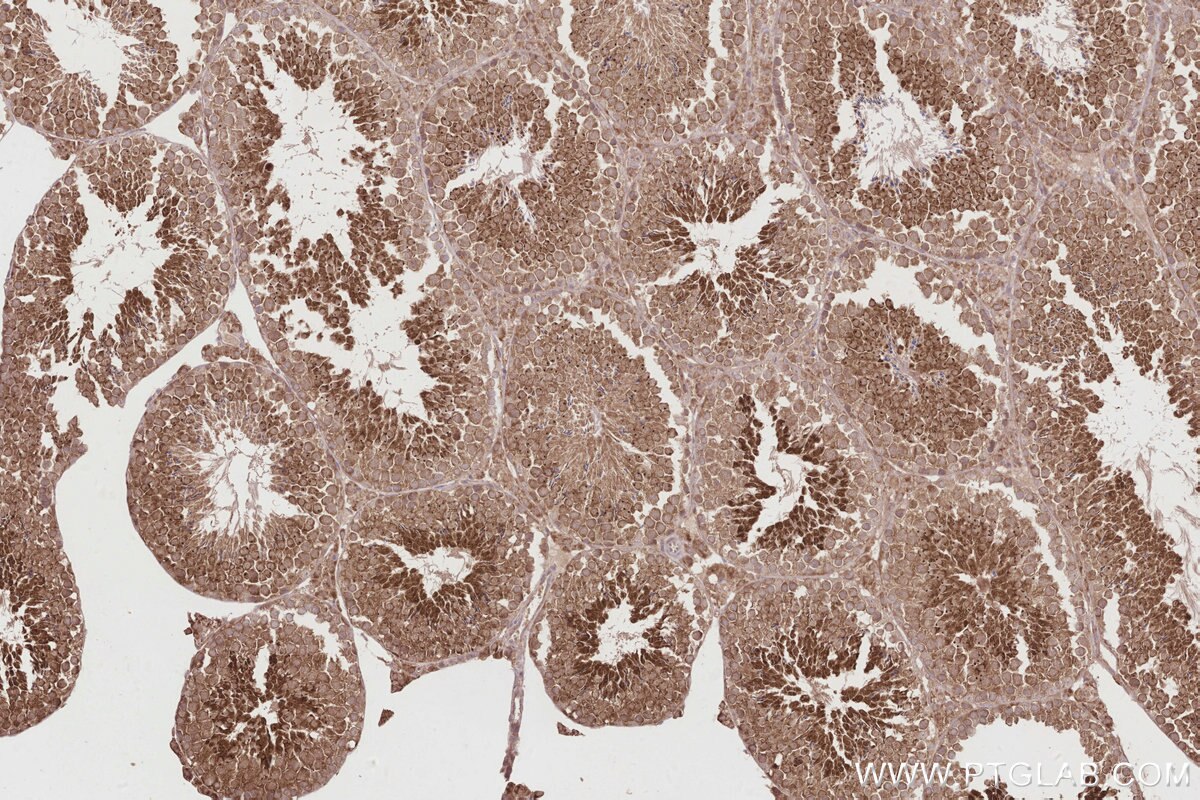 Immunohistochemistry (IHC) staining of mouse testis tissue using KATNB1 Polyclonal antibody (14969-1-AP)