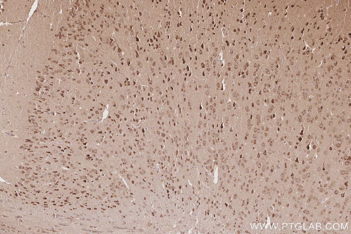 Immunohistochemistry (IHC) staining of mouse brain tissue using KATNB1 Polyclonal antibody (14969-1-AP)