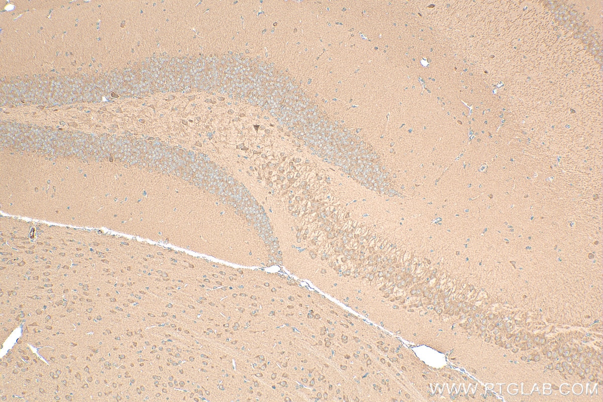 Immunohistochemistry (IHC) staining of mouse brain tissue using KATNB1 Polyclonal antibody (14969-1-AP)
