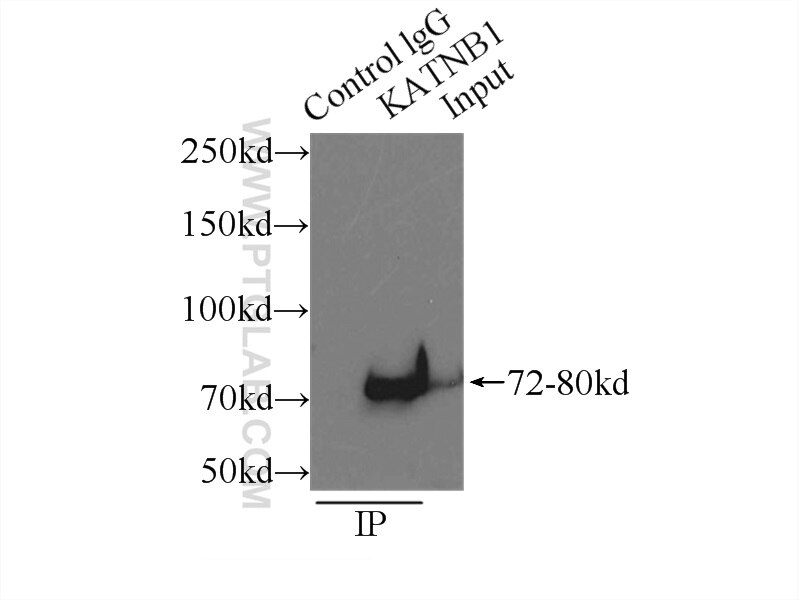 Immunoprecipitation (IP) experiment of HeLa cells using KATNB1 Polyclonal antibody (14969-1-AP)