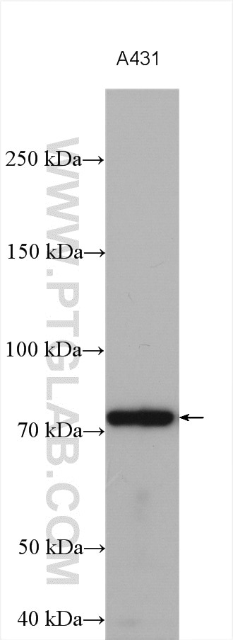 Western Blot (WB) analysis of various lysates using KATNB1 Polyclonal antibody (14969-1-AP)