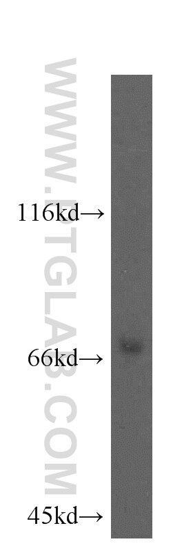 Western Blot (WB) analysis of HepG2 cells using KATNB1 Polyclonal antibody (14969-1-AP)