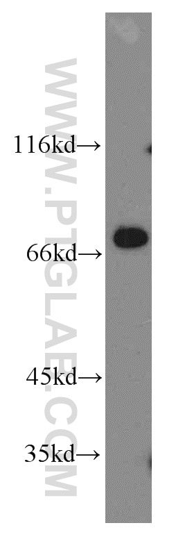 Western Blot (WB) analysis of mouse skeletal muscle tissue using KATNB1 Polyclonal antibody (14969-1-AP)