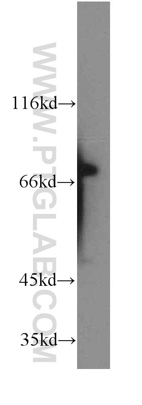 Western Blot (WB) analysis of A431 cells using KATNB1 Polyclonal antibody (14969-1-AP)