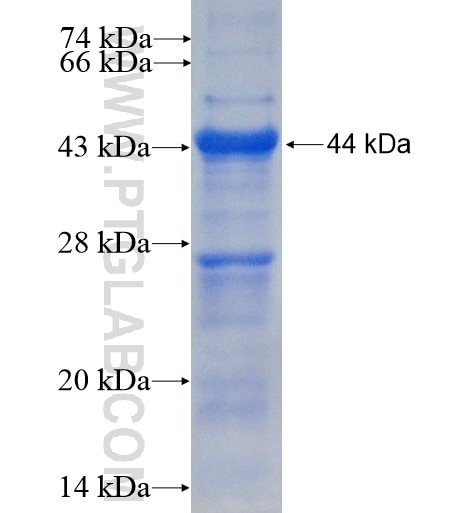 KATNB1 fusion protein Ag14625 SDS-PAGE