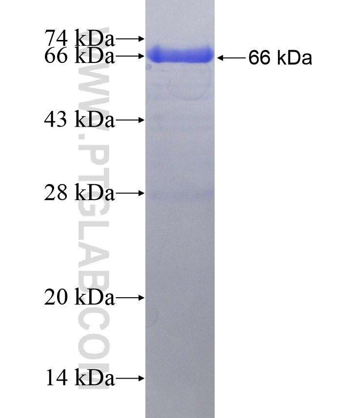 KATNB1 fusion protein Ag6836 SDS-PAGE