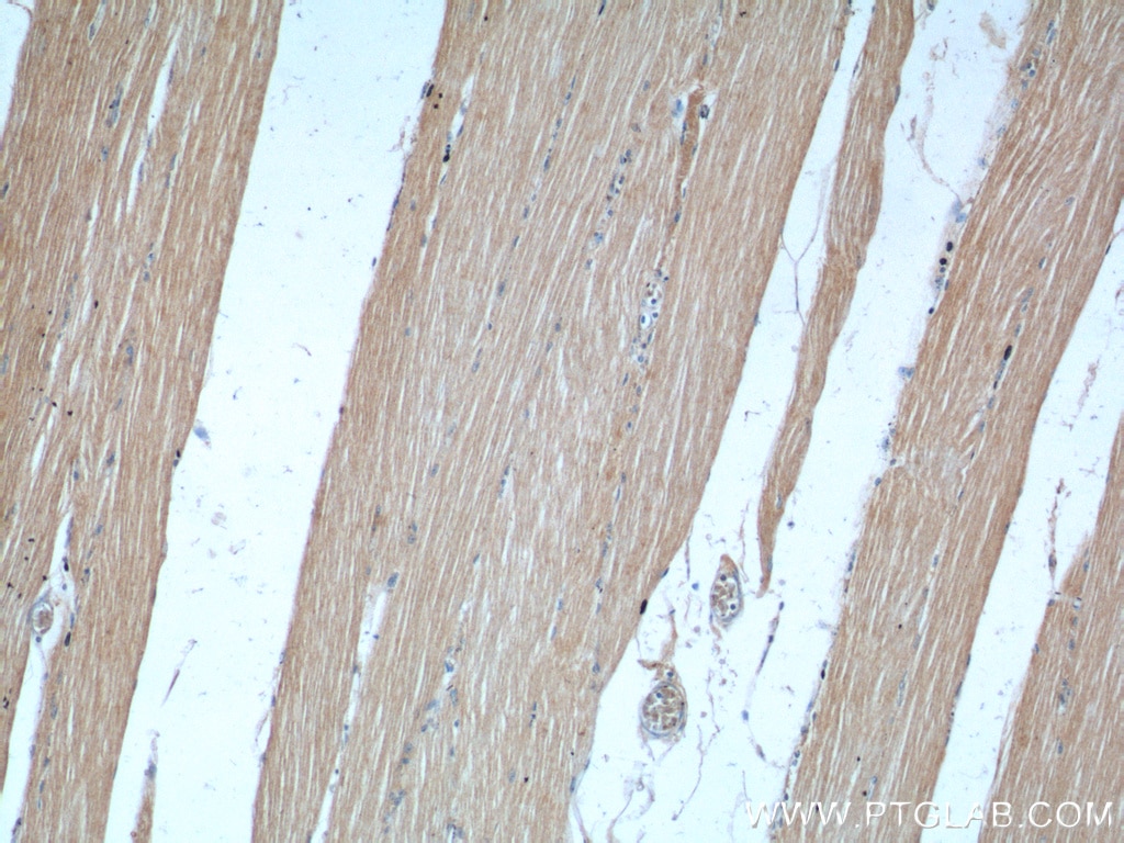 Immunohistochemistry (IHC) staining of human skeletal muscle tissue using KAZALD1 Polyclonal antibody (20815-1-AP)