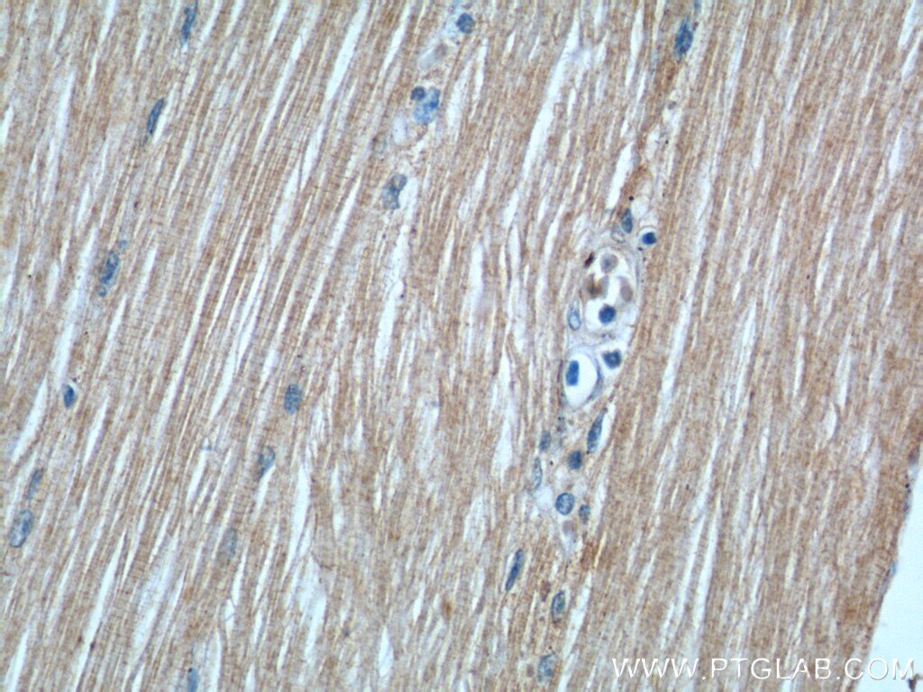 Immunohistochemistry (IHC) staining of human skeletal muscle tissue using KAZALD1 Polyclonal antibody (20815-1-AP)