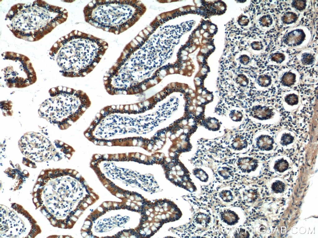 Immunohistochemistry (IHC) staining of human small intestine tissue using KAZALD1 Polyclonal antibody (20815-1-AP)