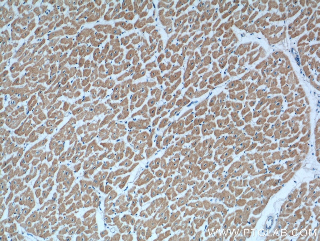 IHC staining of human heart using 20815-1-AP