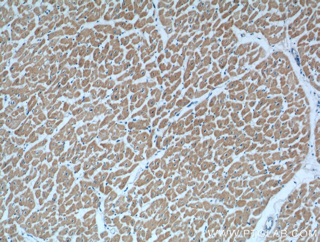 Immunohistochemistry (IHC) staining of human heart tissue using KAZALD1 Polyclonal antibody (20815-1-AP)