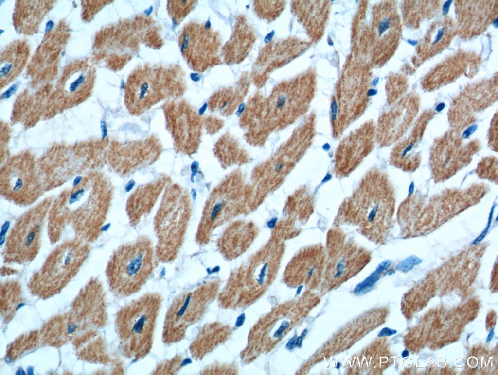 Immunohistochemistry (IHC) staining of human heart tissue using KAZALD1 Polyclonal antibody (20815-1-AP)