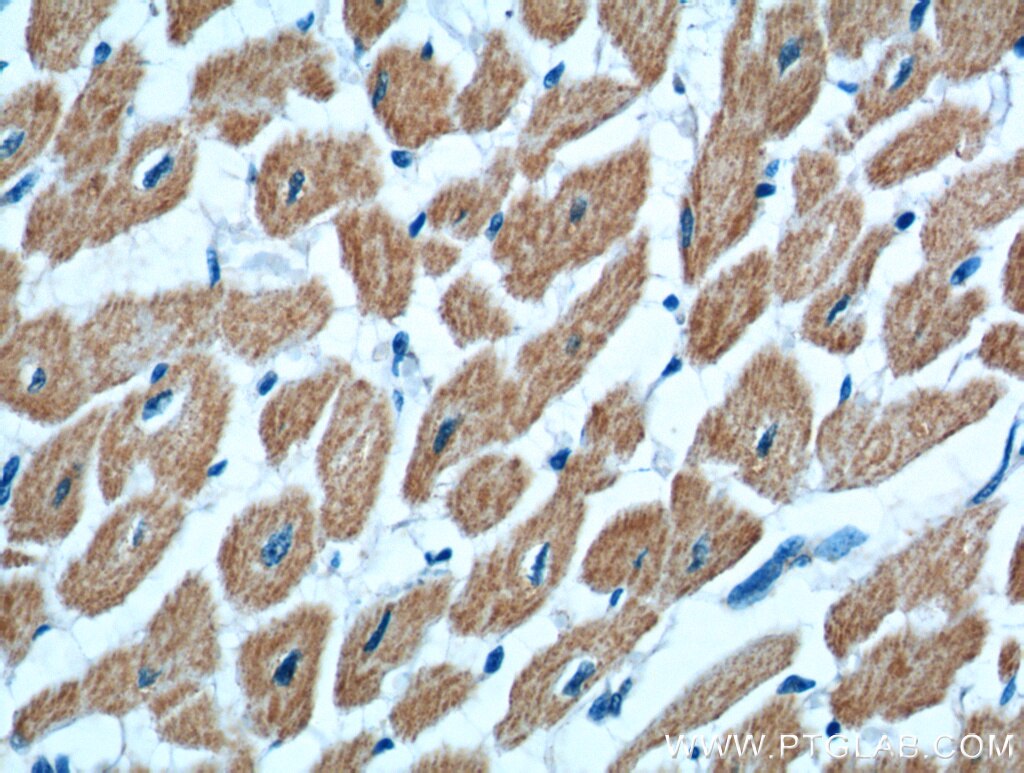 IHC staining of human heart using 20815-1-AP