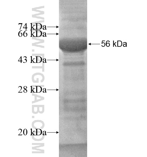 KAZALD1 fusion protein Ag14796 SDS-PAGE