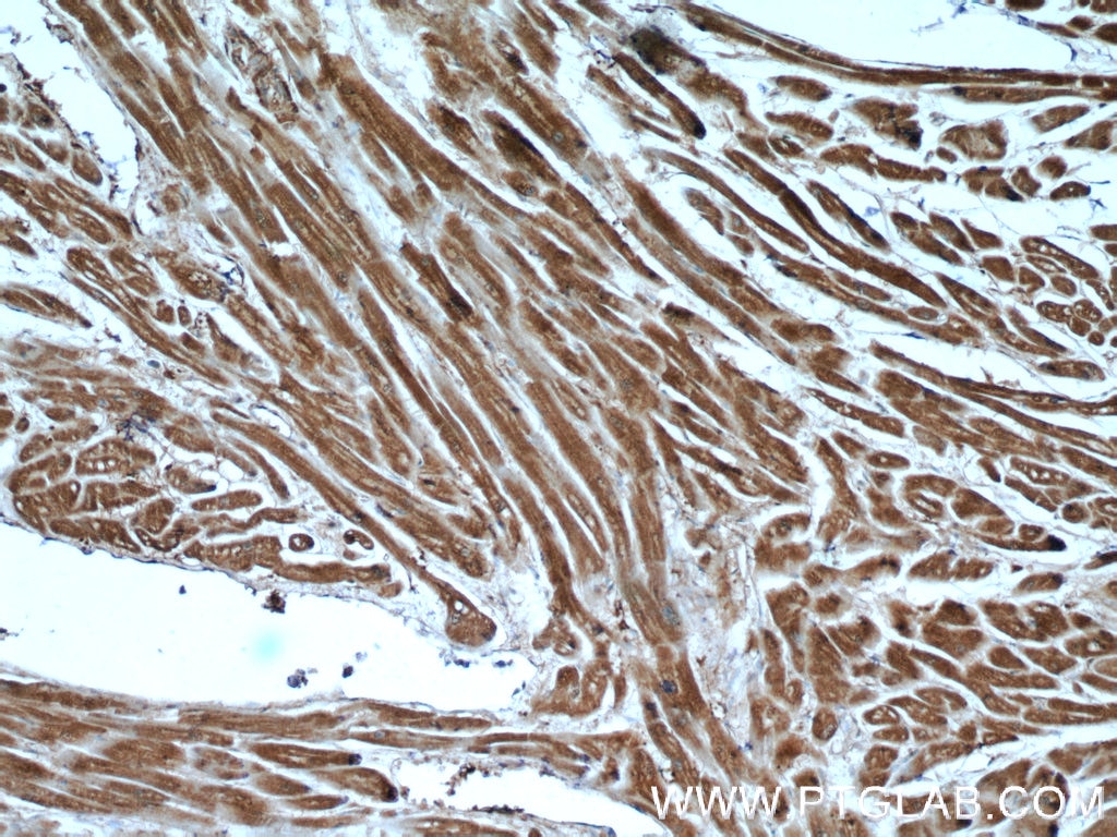 IHC staining of human heart using 25577-1-AP