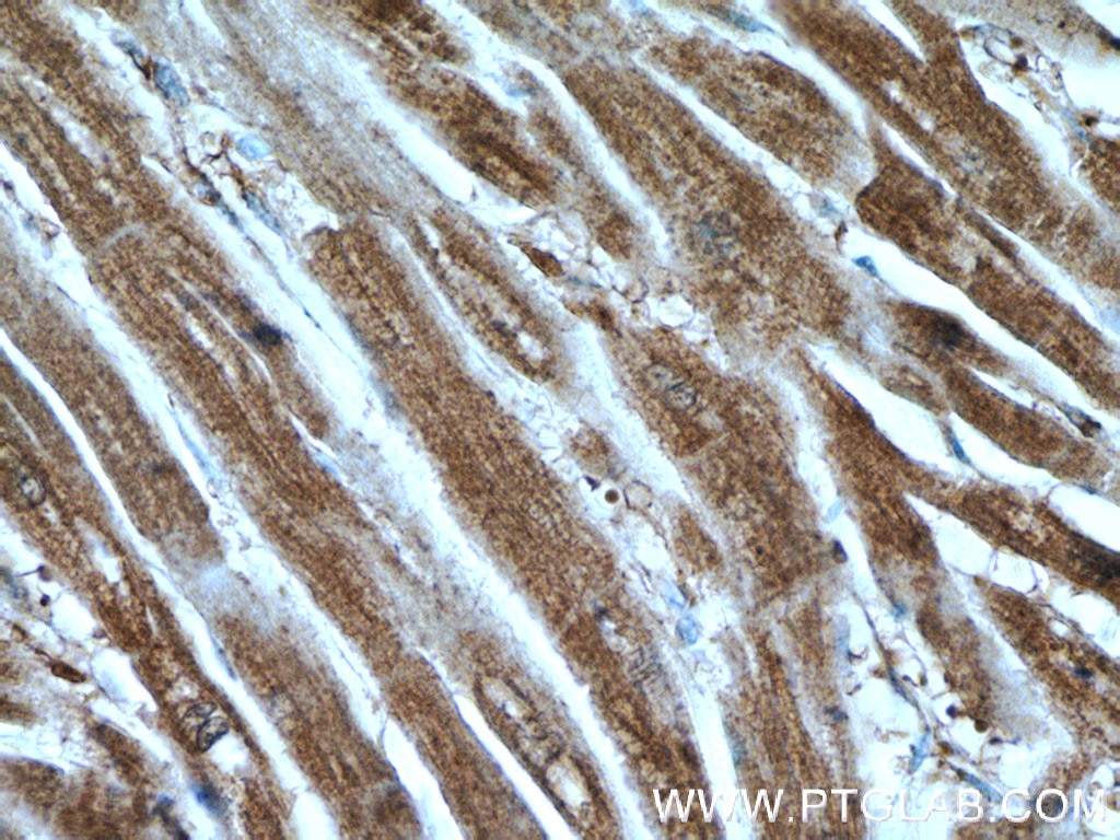 Immunohistochemistry (IHC) staining of human heart tissue using KBTBD10 Polyclonal antibody (25577-1-AP)