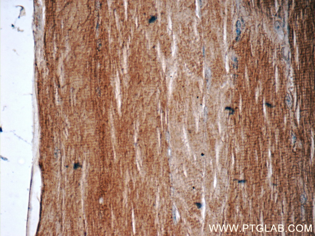 IHC staining of human skeletal muscle using 25577-1-AP