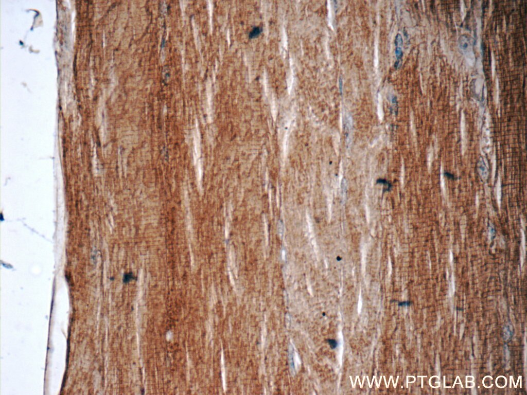 Immunohistochemistry (IHC) staining of human skeletal muscle tissue using KBTBD10 Polyclonal antibody (25577-1-AP)