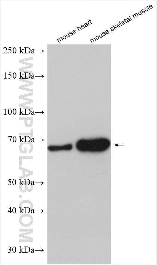 Western Blot (WB) analysis of various lysates using KBTBD10 Polyclonal antibody (25577-1-AP)