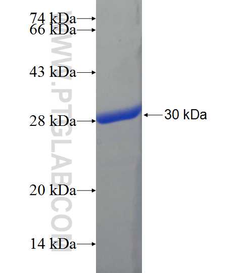KBTBD10 fusion protein Ag22311 SDS-PAGE