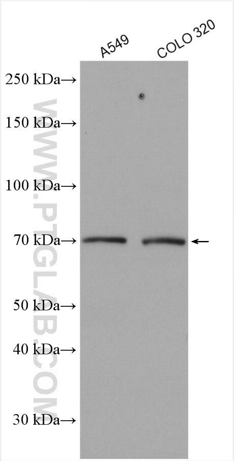Western Blot (WB) analysis of various lysates using KBTBD2 Polyclonal antibody (13871-1-AP)