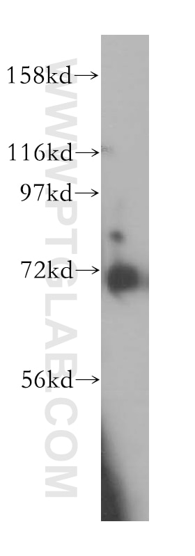 Western Blot (WB) analysis of COLO 320 cells using KBTBD2 Polyclonal antibody (13871-1-AP)
