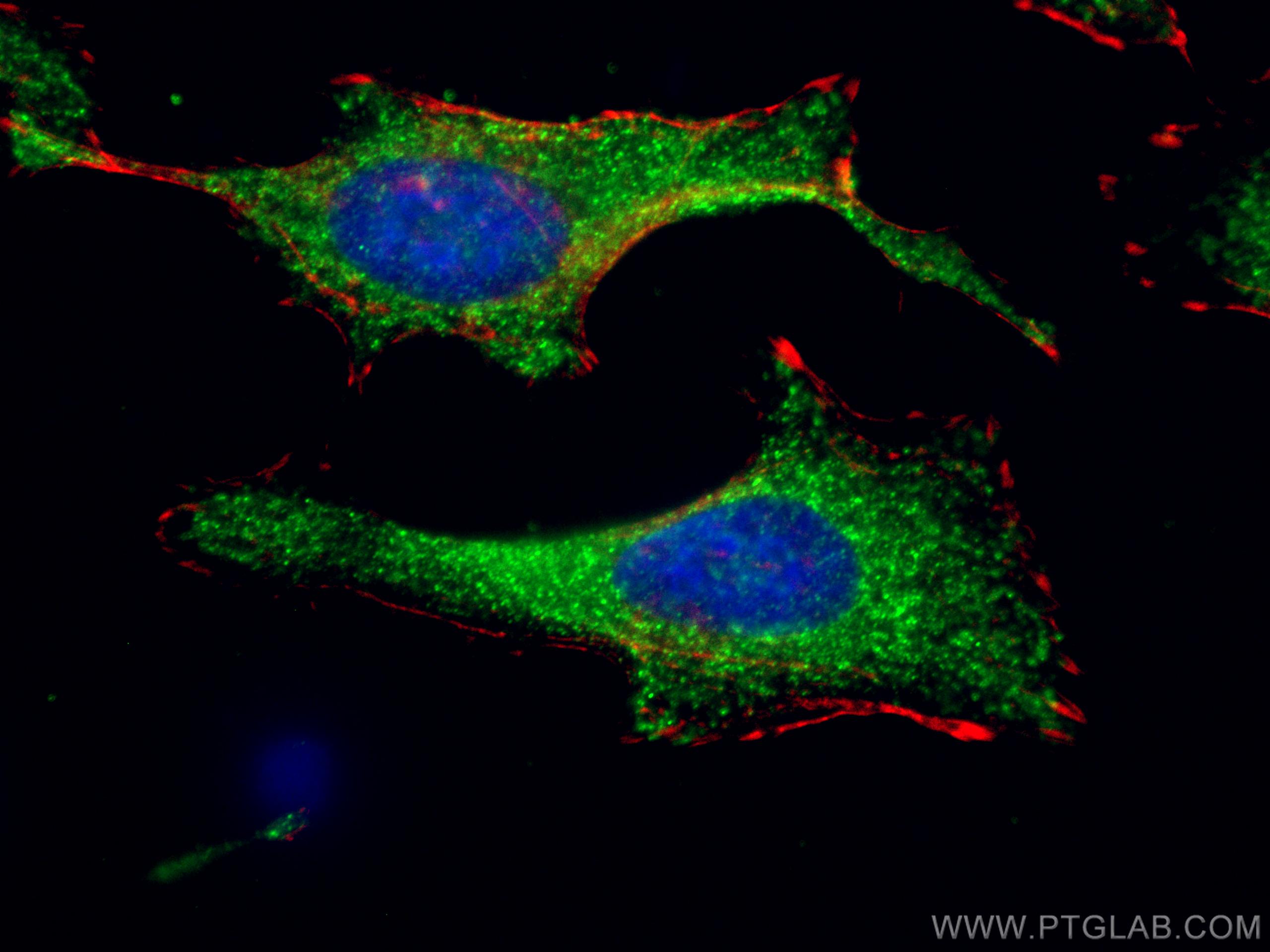 Immunofluorescence (IF) / fluorescent staining of HeLa cells using KBTBD2 Monoclonal antibody (67895-1-Ig)