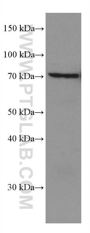 Western Blot (WB) analysis of U2OS cells using KBTBD2 Monoclonal antibody (67895-1-Ig)