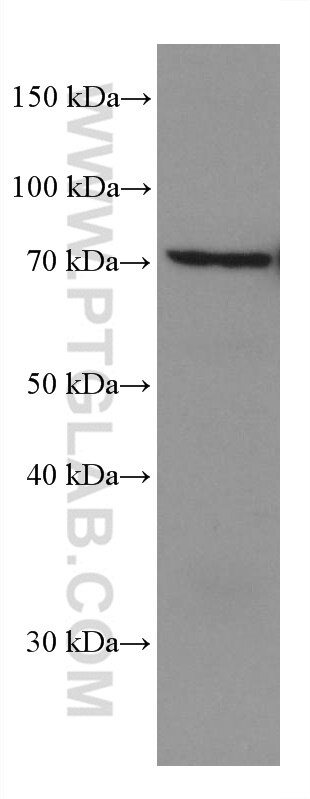 WB analysis of U2OS using 67895-1-Ig
