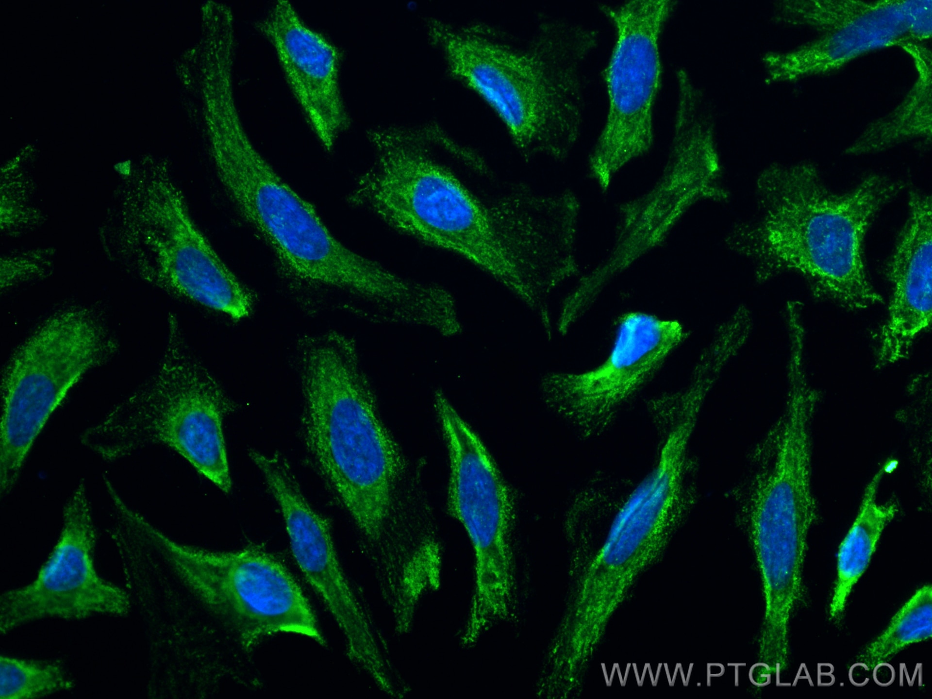 Immunofluorescence (IF) / fluorescent staining of HeLa cells using CoraLite® Plus 488-conjugated KBTBD2 Monoclonal an (CL488-67895)