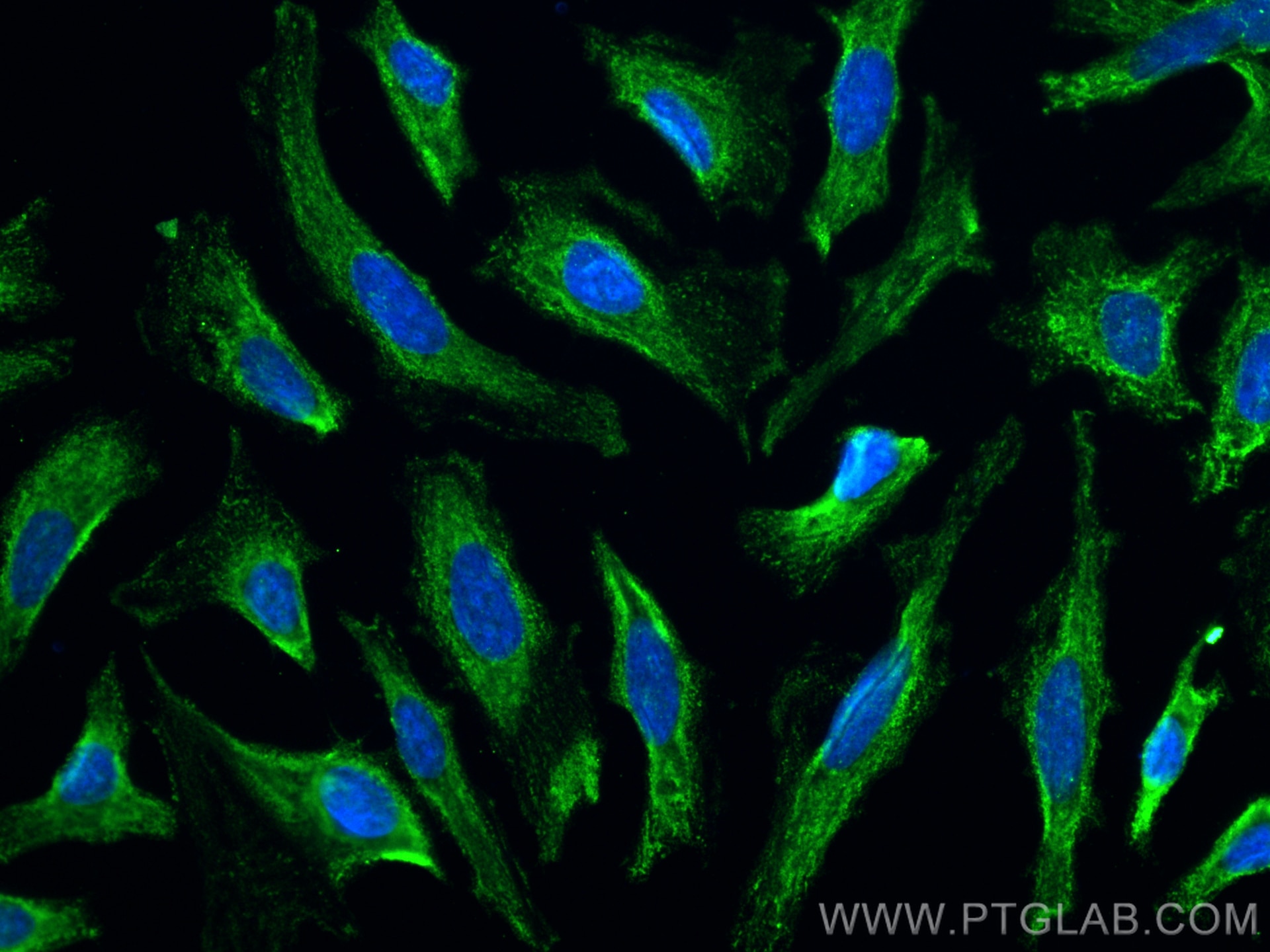 IF Staining of HeLa using CL488-67895