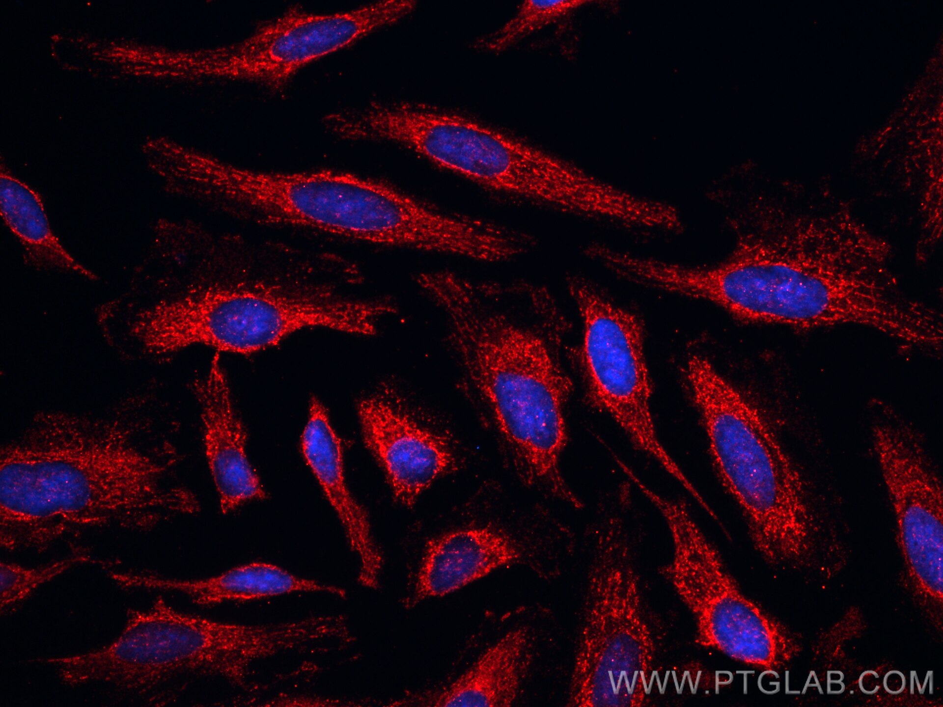 Immunofluorescence (IF) / fluorescent staining of HeLa cells using CoraLite®594-conjugated KBTBD2 Monoclonal antibody (CL594-67895)
