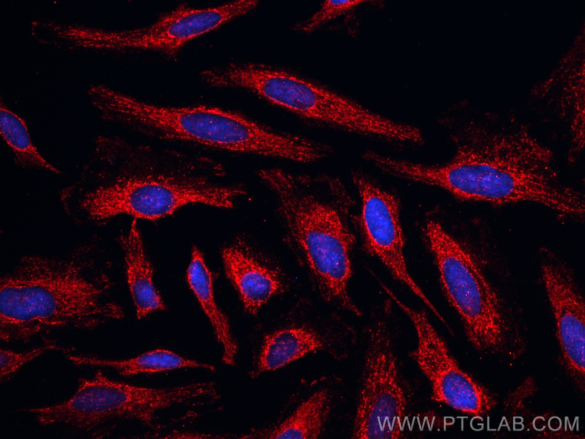 IF Staining of HeLa using CL594-67895