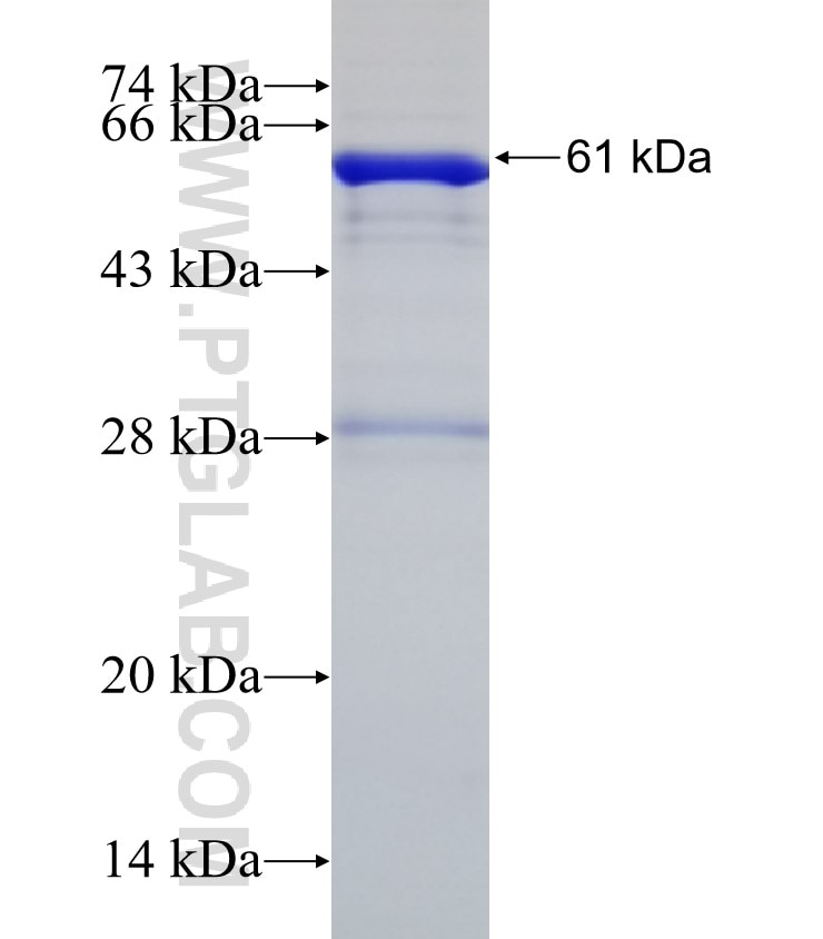 KBTBD2 fusion protein Ag4823 SDS-PAGE